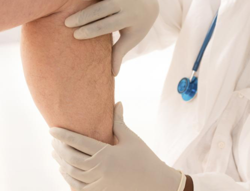 5 Stages of Vein Disease That Shouldn’t Be Ignored